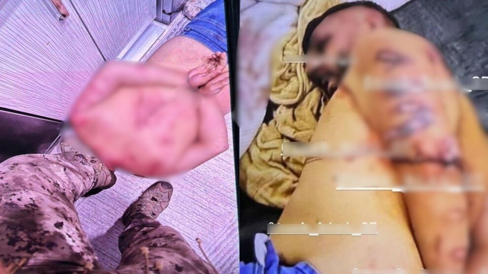 Foto’s tonen sporen van marteling na dodelijke politie-inval in Istanbul